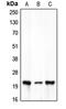 CLDN7 antibody, LS-C352039, Lifespan Biosciences, Western Blot image 