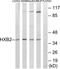 Homeobox B2 antibody, TA314029, Origene, Western Blot image 