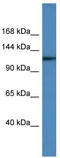 Ubiquitin Specific Peptidase 6 antibody, TA342577, Origene, Western Blot image 
