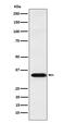 TNF Superfamily Member 13 antibody, M02417-2, Boster Biological Technology, Western Blot image 