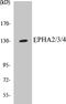 EPH Receptor A2 antibody, EKC1190, Boster Biological Technology, Western Blot image 