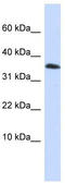 Homeobox protein EMX1 antibody, TA342410, Origene, Western Blot image 