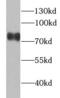 Yes Associated Protein 1 antibody, FNab09827, FineTest, Western Blot image 