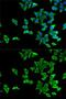 5-Hydroxytryptamine Receptor 2B antibody, GTX32984, GeneTex, Immunofluorescence image 