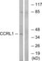 Atypical Chemokine Receptor 4 antibody, LS-C119433, Lifespan Biosciences, Western Blot image 