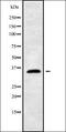 BKRB1 antibody, orb336384, Biorbyt, Western Blot image 
