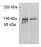ADAM Metallopeptidase With Thrombospondin Type 1 Motif 9 antibody, GTX79416, GeneTex, Western Blot image 