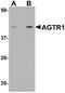 Angiotensin II type-1 receptor antibody, A01213, Boster Biological Technology, Western Blot image 