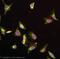 Low Density Lipoprotein Receptor antibody, ab52818, Abcam, Immunofluorescence image 