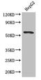 DEAD-Box Helicase 6 antibody, CSB-PA006640LA01HU, Cusabio, Western Blot image 