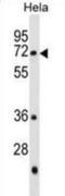 Polypeptide N-Acetylgalactosaminyltransferase 13 antibody, abx030102, Abbexa, Western Blot image 