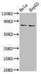 Epithelial Splicing Regulatory Protein 2 antibody, CSB-PA007833LA01HU, Cusabio, Western Blot image 