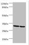 Purine Nucleoside Phosphorylase antibody, orb352916, Biorbyt, Western Blot image 