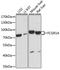 Fc-gamma RI antibody, A1197, ABclonal Technology, Western Blot image 