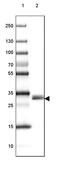 Tryptase Beta 2 (Gene/Pseudogene) antibody, PA5-61897, Invitrogen Antibodies, Western Blot image 