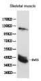 Blood Vessel Epicardial Substance antibody, LS-C192233, Lifespan Biosciences, Western Blot image 