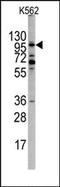 EPH Receptor A10 antibody, AP14292PU-N, Origene, Western Blot image 