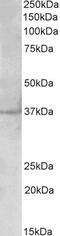Cleavage stimulation factor subunit 3 antibody, 43-260, ProSci, Western Blot image 