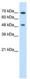 RAD23 Homolog A, Nucleotide Excision Repair Protein antibody, TA346391, Origene, Western Blot image 