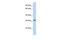 Lysophospholipase 2 antibody, PA5-44919, Invitrogen Antibodies, Western Blot image 