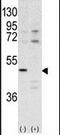 Cyclin-dependent kinase 10 antibody, PA5-14435, Invitrogen Antibodies, Western Blot image 