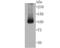 10-FTHFDH antibody, A04615, Boster Biological Technology, Western Blot image 