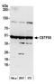 Cleavage Stimulation Factor Subunit 1 antibody, A301-250A, Bethyl Labs, Western Blot image 