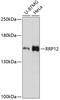 Ribosomal RNA Processing 12 Homolog antibody, 14-783, ProSci, Western Blot image 