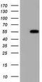 HsMAD2 antibody, GTX83612, GeneTex, Western Blot image 