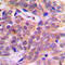 Catenin Beta 1 antibody, LS-C353985, Lifespan Biosciences, Immunohistochemistry paraffin image 