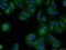 MAGE Family Member B18 antibody, 17494-1-AP, Proteintech Group, Immunofluorescence image 
