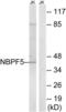 Neuroblastoma breakpoint family member 5 antibody, LS-C120150, Lifespan Biosciences, Western Blot image 