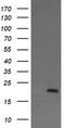 Anaphase Promoting Complex Subunit 11 antibody, TA506321AM, Origene, Western Blot image 