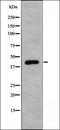 ADP Ribosylation Factor Guanine Nucleotide Exchange Factor 2 antibody, orb226375, Biorbyt, Western Blot image 