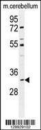 AlkB Homolog 6 antibody, 55-757, ProSci, Western Blot image 