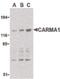 Caspase recruitment domain-containing protein 11 antibody, PA5-20032, Invitrogen Antibodies, Western Blot image 