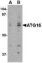 Autophagy Related 16 Like 1 antibody, TA306514, Origene, Western Blot image 