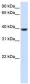 1-Acylglycerol-3-Phosphate O-Acyltransferase 5 antibody, TA342370, Origene, Western Blot image 