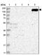 GTPase Activating Protein And VPS9 Domains 1 antibody, NBP1-85136, Novus Biologicals, Western Blot image 