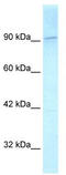 Kinesin Family Member 1C antibody, TA334693, Origene, Western Blot image 