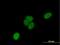 Uncharacterized protein C1orf103 antibody, H00055791-B01P, Novus Biologicals, Immunofluorescence image 