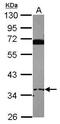EP300 Interacting Inhibitor Of Differentiation 3 antibody, PA5-31556, Invitrogen Antibodies, Western Blot image 