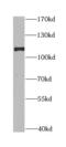 Discs Large MAGUK Scaffold Protein 1 antibody, FNab02409, FineTest, Western Blot image 