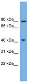 Dual Specificity Tyrosine Phosphorylation Regulated Kinase 1A antibody, TA338911, Origene, Western Blot image 