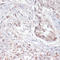 Janus Kinase 2 antibody, A00027Y1007-1, Boster Biological Technology, Immunohistochemistry frozen image 