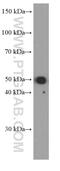 WT1 Associated Protein antibody, 60188-1-Ig, Proteintech Group, Western Blot image 