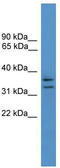 Secretory Carrier Membrane Protein 3 antibody, TA342622, Origene, Western Blot image 