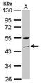 Zinc Finger Protein 514 antibody, PA5-31307, Invitrogen Antibodies, Western Blot image 