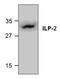 Baculoviral IAP Repeat Containing 8 antibody, GTX59774, GeneTex, Western Blot image 