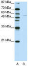 Grainyhead Like Transcription Factor 3 antibody, TA345326, Origene, Western Blot image 